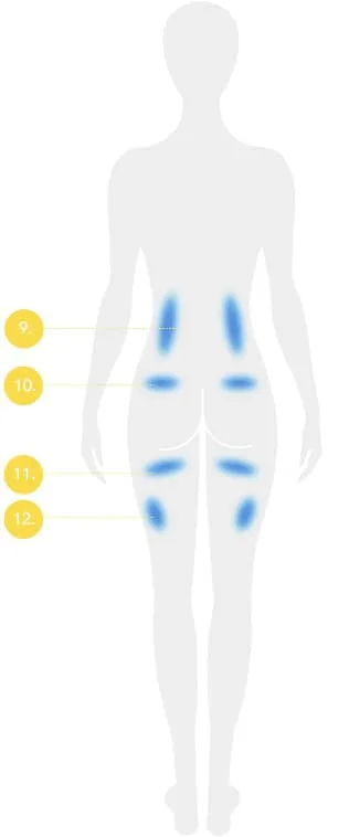 Back body diagram with numbered treatable fat areas for CoolSculpting fat freezing in Amsterdam