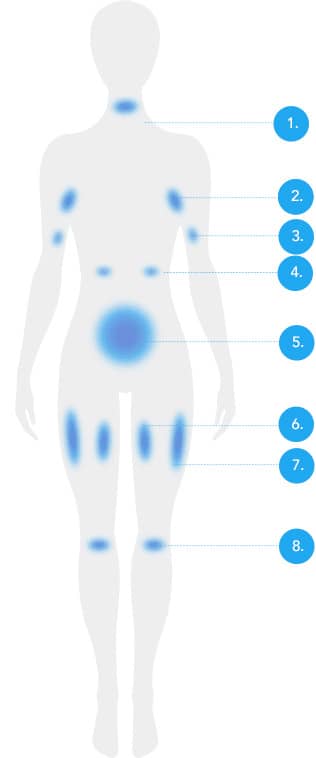 Front body diagram with numbered treatable fat areas for CoolSculpting fat freezing in Amsterdam